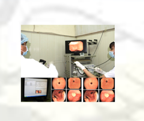 Thông tin về nội soi tiêu hóa