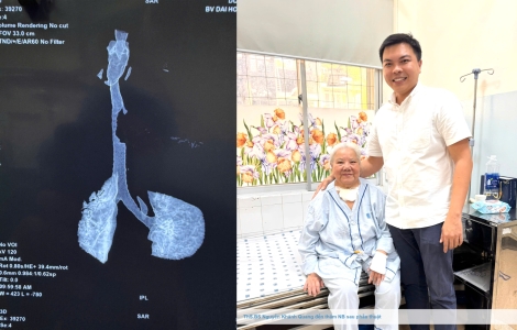 Một nắm xôi – một đời thương!