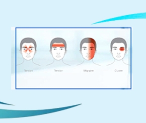 Đau đầu Migraine