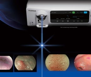 Chẩn đoán Ung Thư Dạ dày Giai đoạn sớm - Bước tiến mới tại Bệnh viện Đại học Y Dược Thành phố Hồ Chí Minh - Cơ sở 2