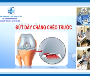 Phẫu thuật nội soi tái tạo dây chằng chéo trước !