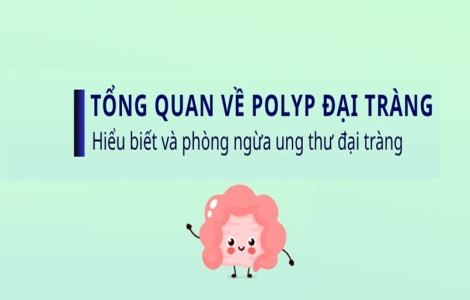 Tổng quan về Polyp đại tràng