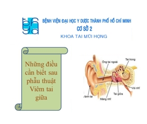 Những điều cần biết sau phẫu thuật Viêm tai giữa