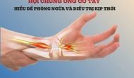 Hội chứng Ống cổ tay - Hiểu để phòng ngừa và điều trị kịp thời